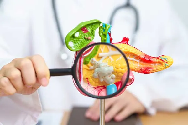 Gallbladder Polyp Surgery | Dr. Ashutosh Nayak